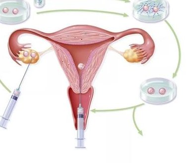 在临沂做第三代试管婴儿的成功率是多少？影响成功率的因素有哪些？